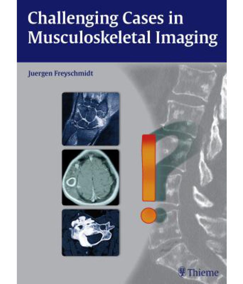 Challenging Cases in Musculoskeletal Imaging Buy Challenging Cases in Musculoskeletal Imaging