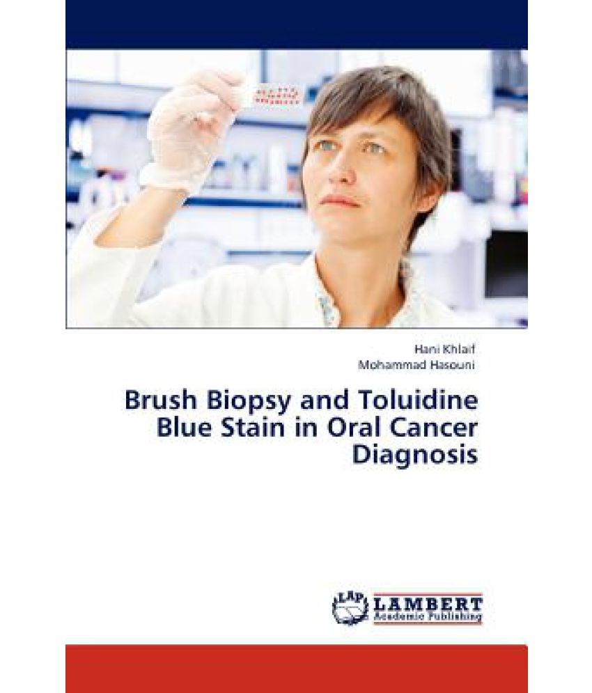 Brush Biopsy and Toluidine Blue Stain in Oral Cancer Diagnosis Buy