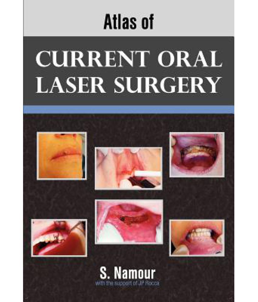 Atlas of Current Oral Laser Surgery Buy Atlas of Current Oral Laser