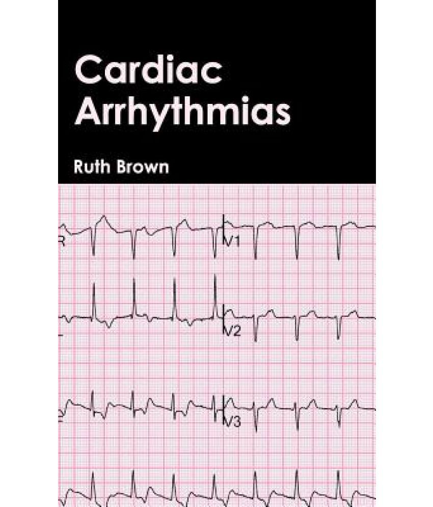 heart arrhythmia