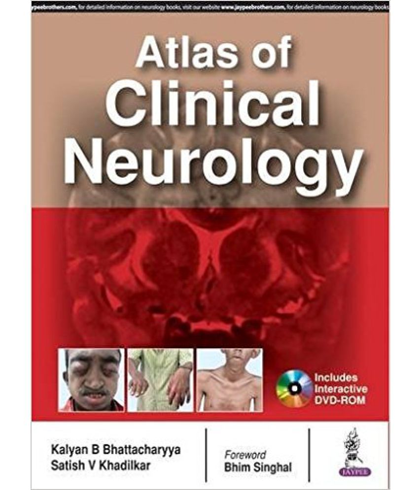 Atlas Of Neurology A Case Based Approach Buy Atlas Of Neurology A Case