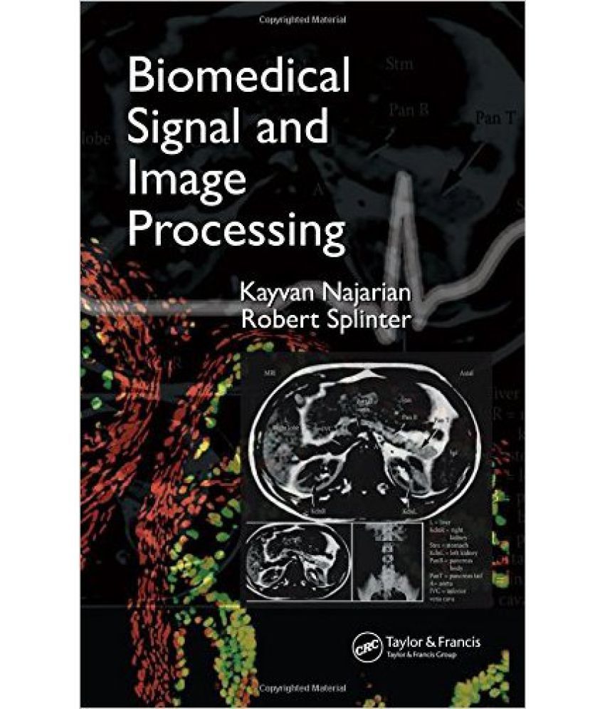 Biomedical Signal & Image Processing Buy Biomedical Signal & Image Processing Online at Low
