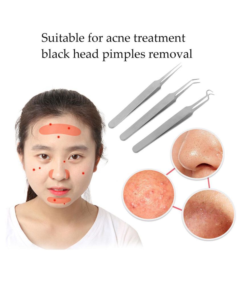 3 Pcs Acne Comedone Tweezers Blackhead Pimples Removal Clip Face Skin Care Tools Buy 3 Pcs Acne