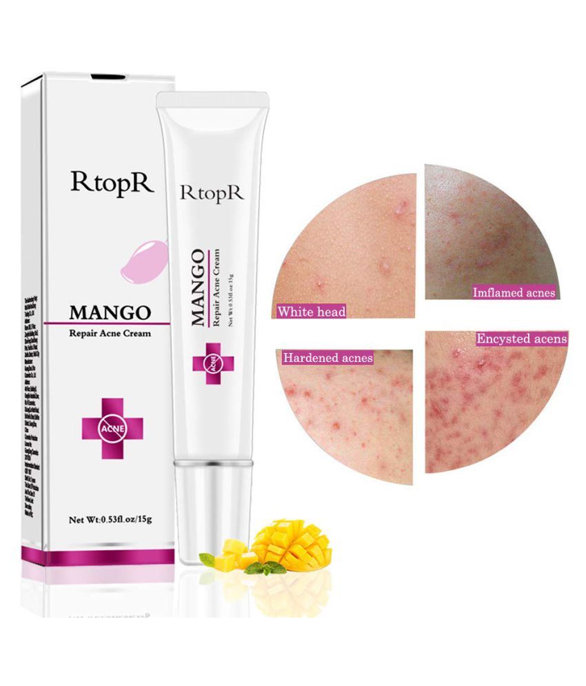 mango repair acne cream
