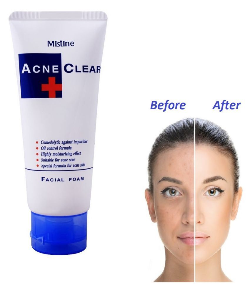 Acne control mesopharm маска