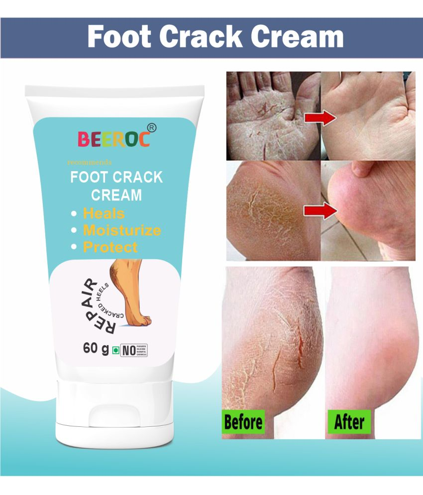     			BEEROC Cracked skin repair Cream for All year ( 60 g )