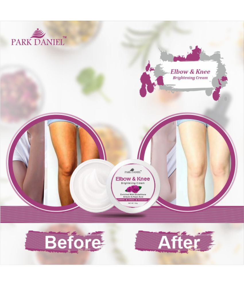     			Park Daniel Elbow and Knee Skin Whitening Cream to Remove Dark Spots Pack of 1 of 100 Grams