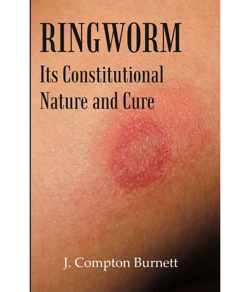     			Ringworm: Its Constitutional Nature and Cure [Hardcover]