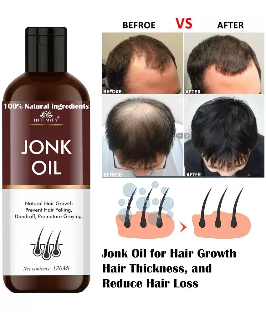 6Drops Natural  Organic Jonk Leech Oil for Hair Growth  Anti Dandruff Hair  Fall Hair Oil  Price in India Buy 6Drops Natural  Organic Jonk Leech Oil  for Hair Growth