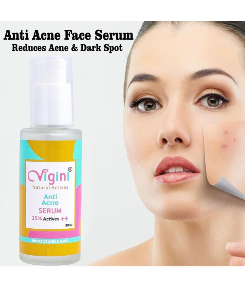     			Vigini 20% Actives Anti-Acne Oil Control Face Serum-30ml Blackheads Whiteheads Men Women Use with Soap Scrub Free Remover Face Wash Prone Oily Skin, Removes Pimples Pigmentation Pore Tightening Use Cream Gel Facial Kit Pack Day Night,  Alpha Arbutin