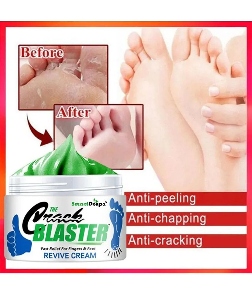 Smartdrops Chapped Hand And Foot Cream Crack Peeling Repair Anti Dry Skin Remove  Dead Skin Foot Moisturizing (50gm) (For Women and men) Pack of 4