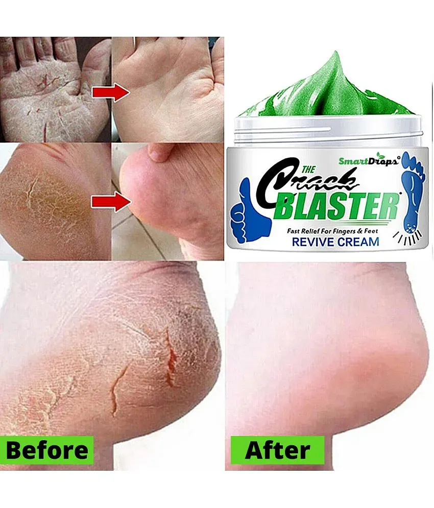 Smartdrops Chapped Hand And Foot Cream Crack Peeling Repair Anti Dry Skin Remove  Dead Skin Foot Moisturizing (50gm) (For Women and men) Pack of 4