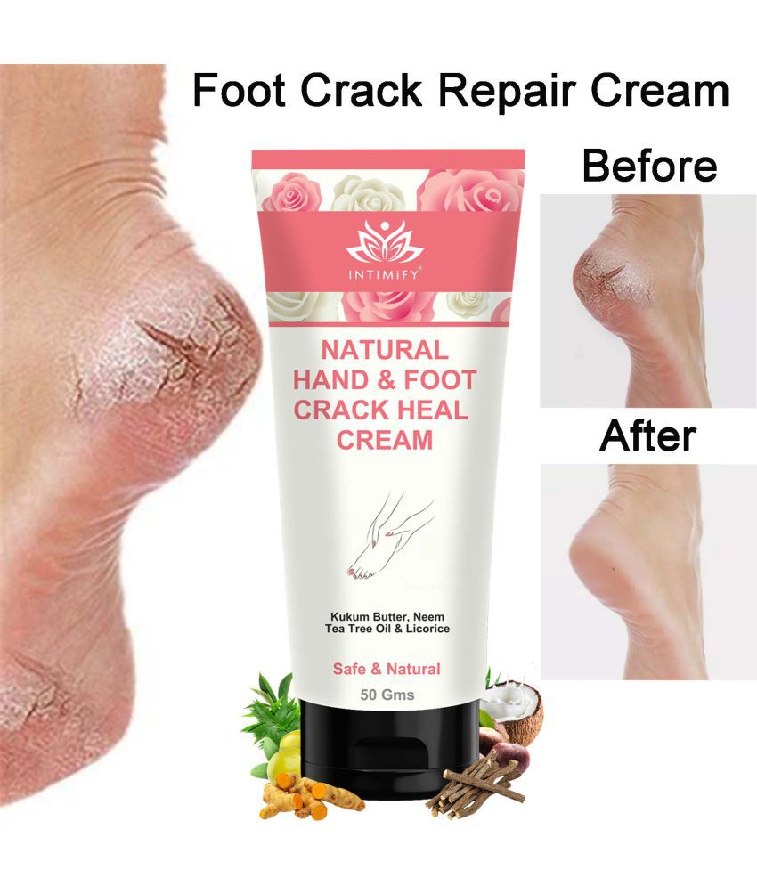 Intimify Foot Crack Cream Foot Cream Lotion Foot Cream ( 50 g )