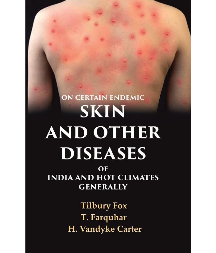     			On Certain Endemic Skin and Other Diseases of India and Hot Climates Generally
