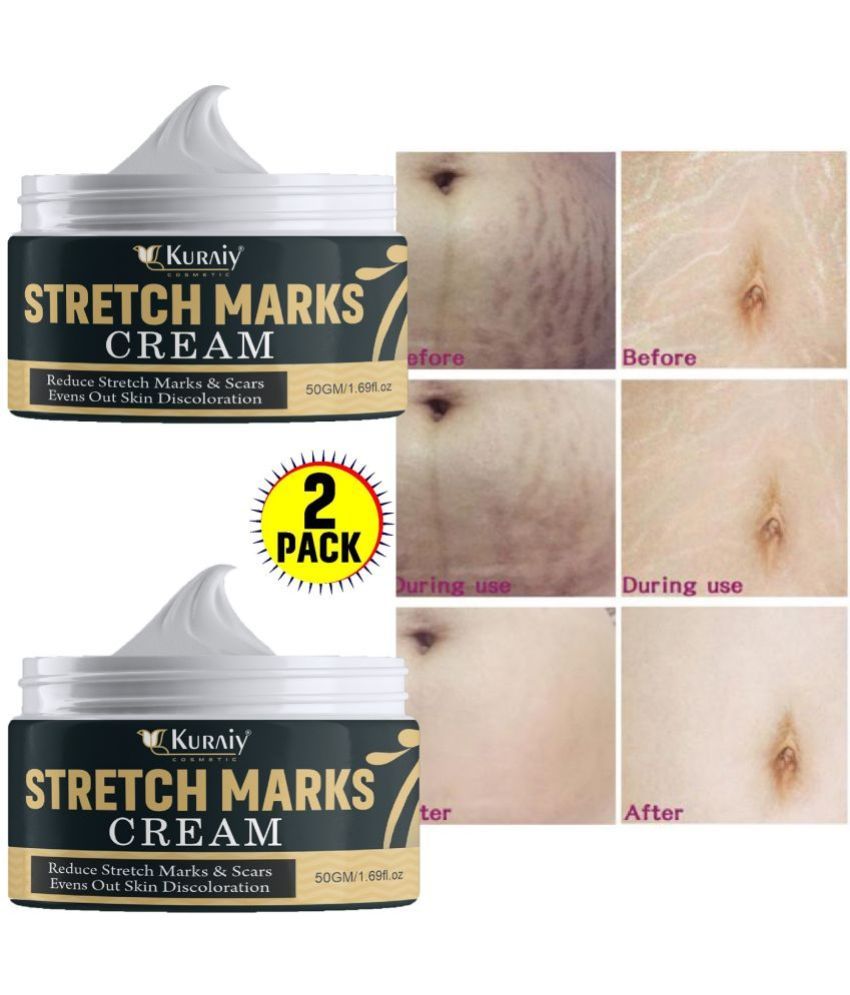     			KURAIY Remove Pregnancy Mark Body Cream Treatment Scars Acne Stretch Marks Cream Maternity Repair