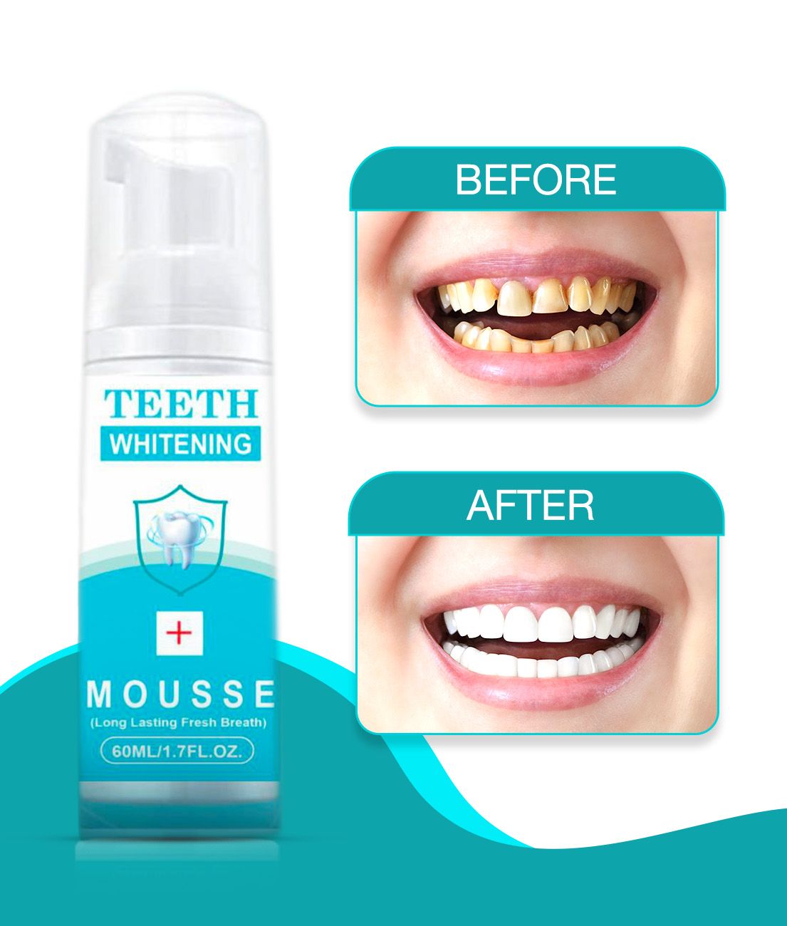     			REGOLITH teeth whitening foam Denture Oral Kit