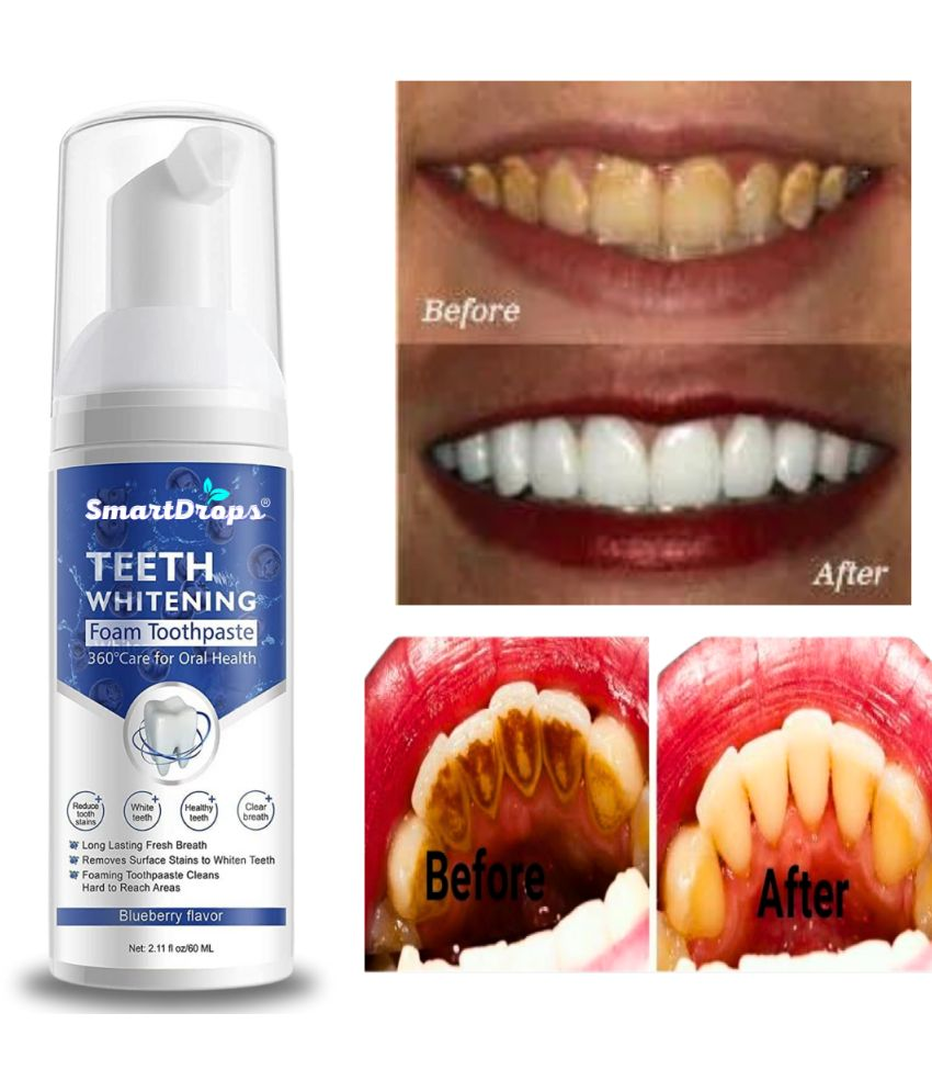     			Smartdrops Dentist Recommended Denture Oral Kit