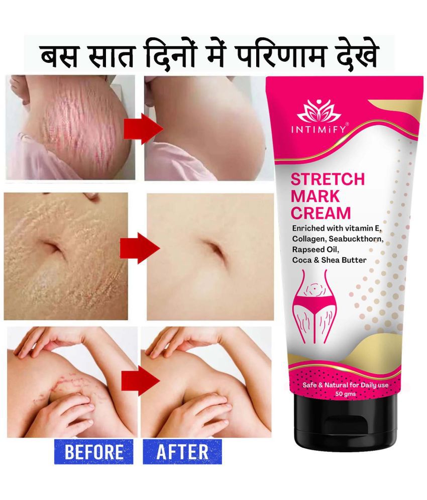     			Intimify Stretch Mark Cream, Stretch Mark Remover Cream, Shaping & Firming Cream 50 gms
