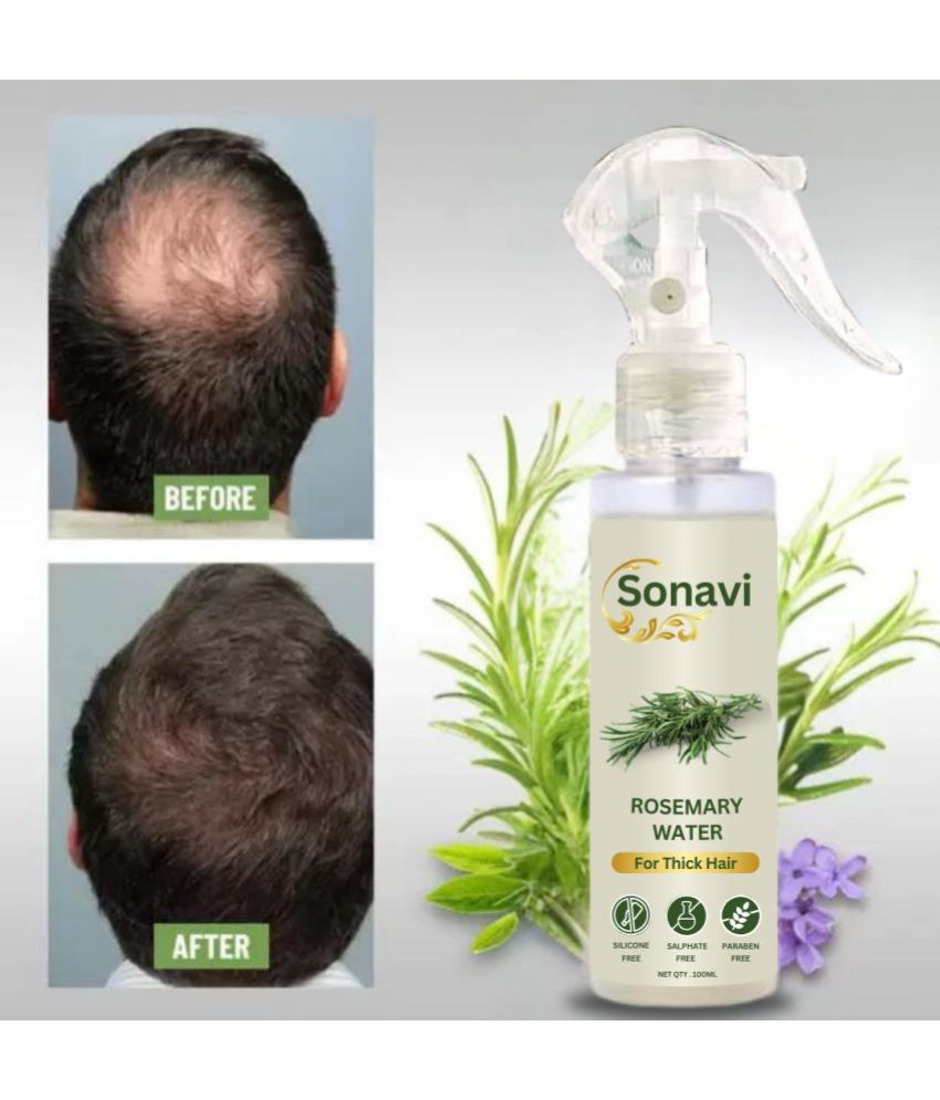     			Sonavi Anti Dandruff Rosemary Oil 100 ml ( Pack of 1 )