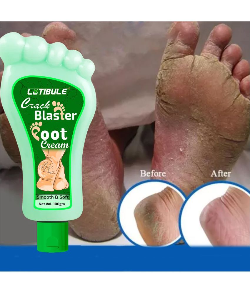     			Latibule Anti Itch Crack Blaster Foot Cream For Soft & Smooth Foot, 100 ml, pack of 1