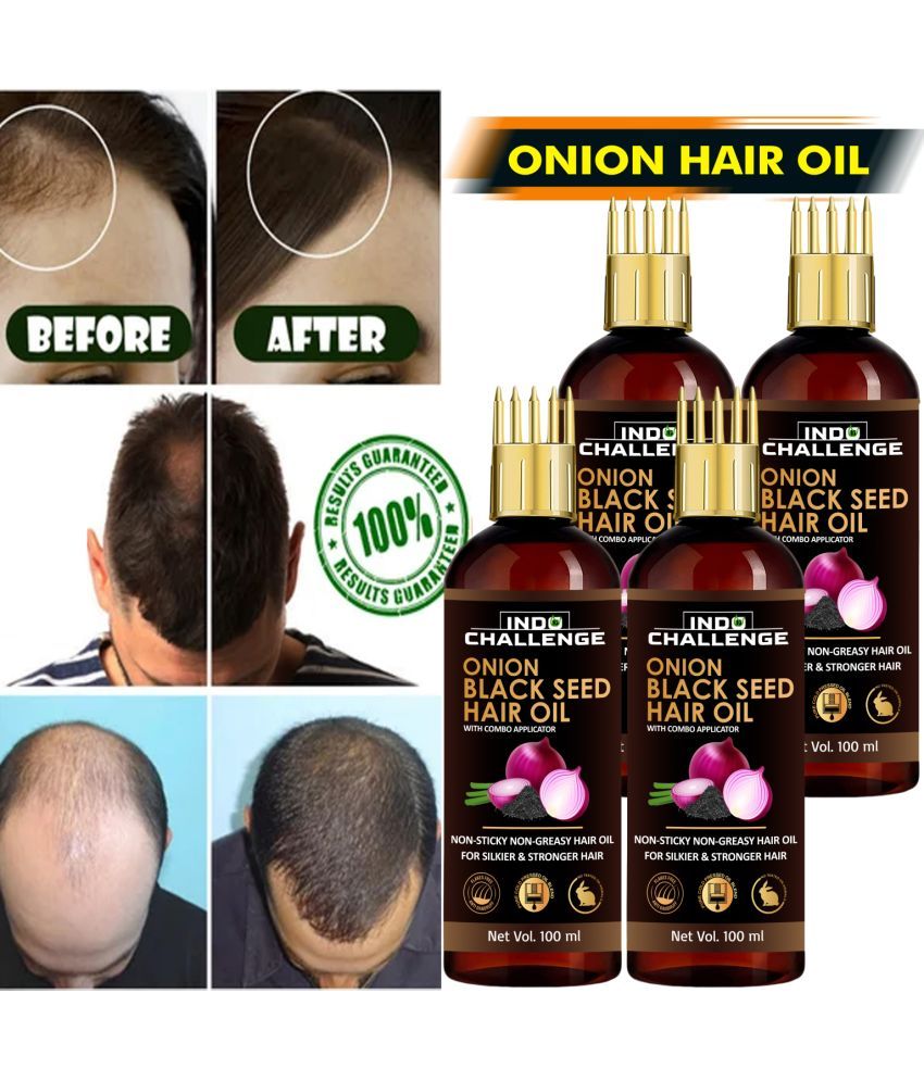     			INDO CHALLEGE Anti Hair Fall Onion Oil 100 ml ( Pack of 4 )