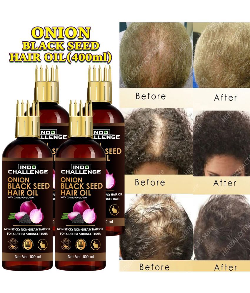     			INDO CHALLEGE Anti Hair Fall Onion Oil 100 ml ( Pack of 4 )