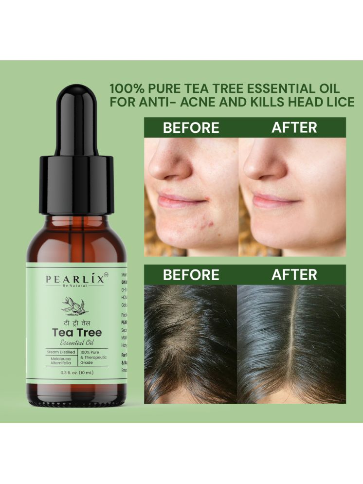     			PEARLIX Tea Tree Anti Skin Irritation Essential Oil Green 10 mL ( Pack of 1 )